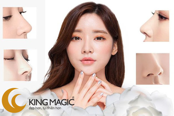 Nâng mũi cấu trúc