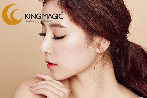 Nâng mũi sụn nhân tạo
