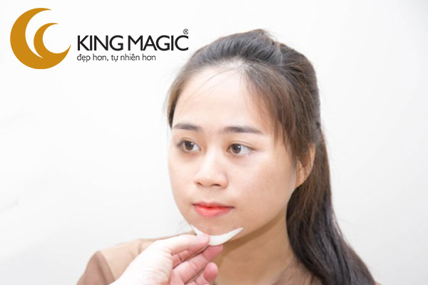 Phẫu thuật cằm lẹm