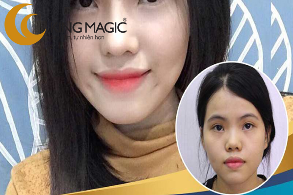Phẫu thuật đồng điếu