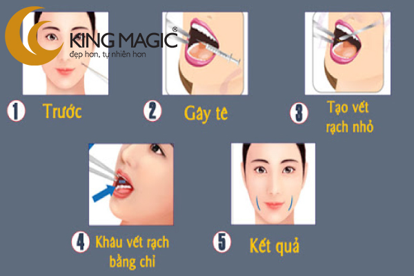 Phẫu thuật đồng điếu