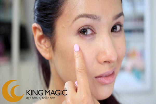 Phẫu thuật lấy da/mỡ mí dưới