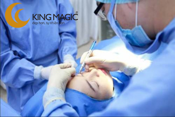 Phẫu thuật xử lý sẹo vùng mắt