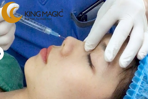 tiêm filler